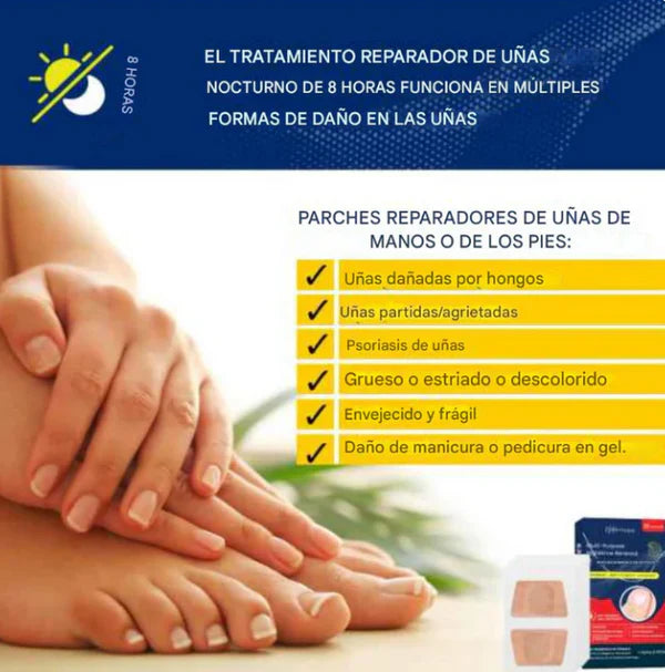 HOY 2X1! "Lleva 1 caja Gratis" Parches de TERBINAFINA 1% Tratamiento Fácil, Limpio y Efectivo